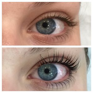 Refine Before & After