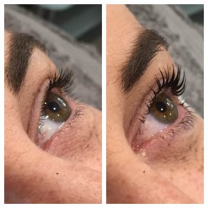 Refine Customer Treatment Gallery