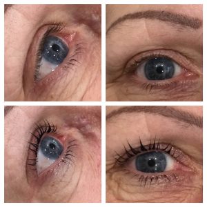 Refine Customer Treatment Gallery