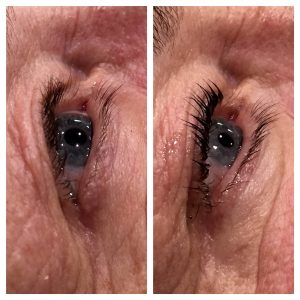 Refine Treatment Gallery3