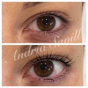 Refine Treatment Gallery4